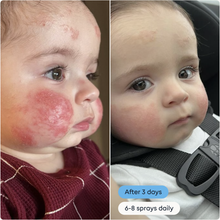 Magic Molecule Hypochlorous Acid Daily Skin Spray