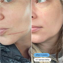 Magic Molecule Hypochlorous Acid Daily Skin Spray