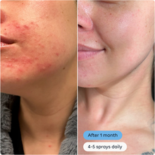 Magic Molecule Hypochlorous Acid Daily Skin Spray
